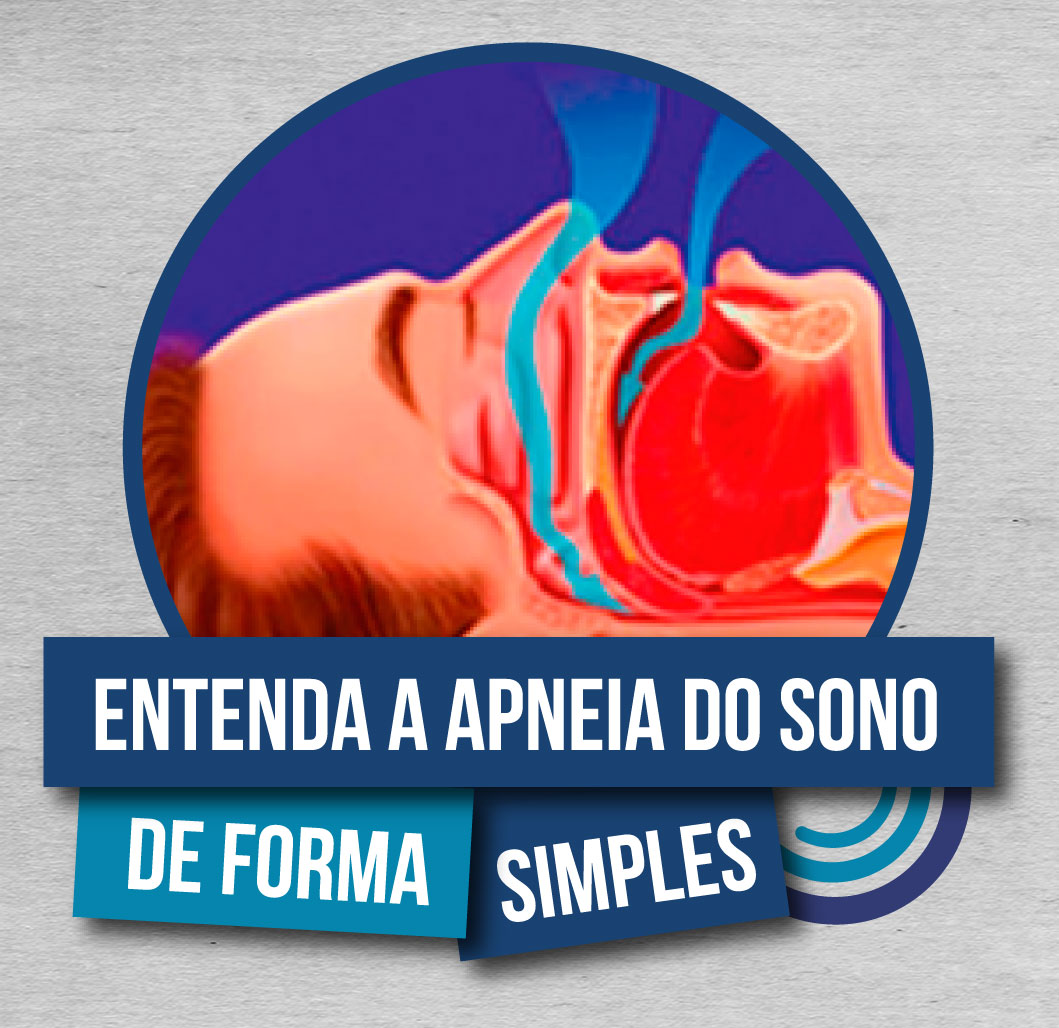 Read more about the article Entenda a Apneia Obstrutiva do Sono